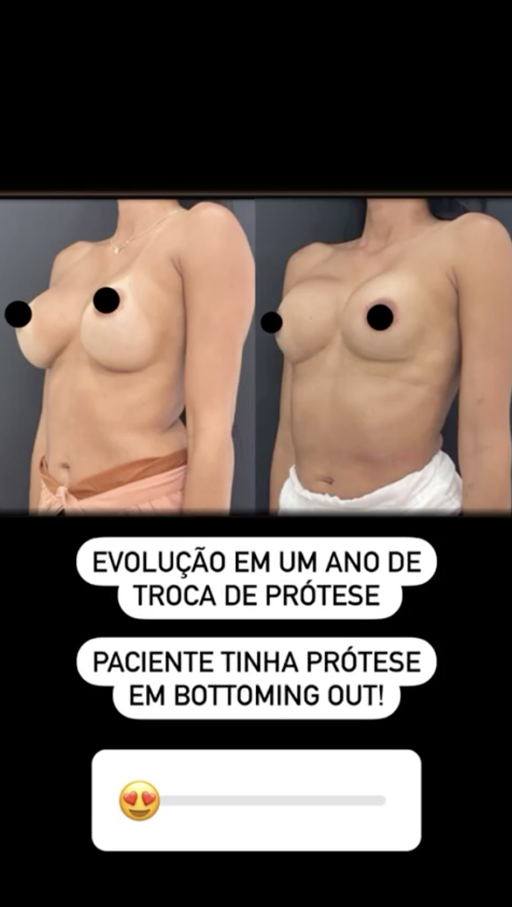 andre-nepomuceno-resultados-14.png